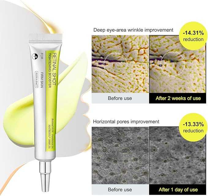 Retinol Shot Tightening Booster Serum – Anti-Aging Face Cream for Firming